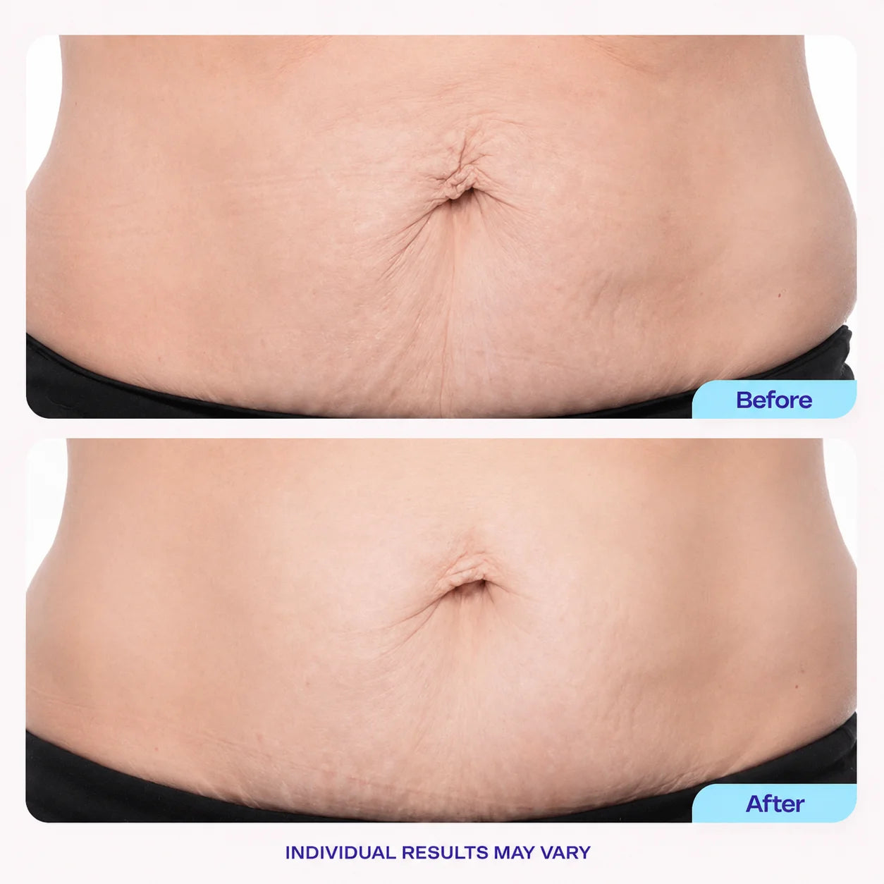 Herblow™ Tighten & Smooth Belly Cream