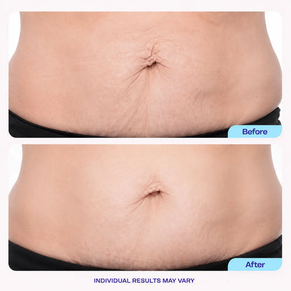Herblow™ Tighten & Smooth Belly Cream