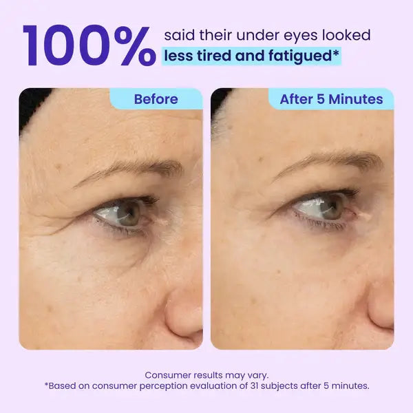 Herblow Eye Bag Instant Eraser, Tightens, Firms, & Blurs Wrinkles