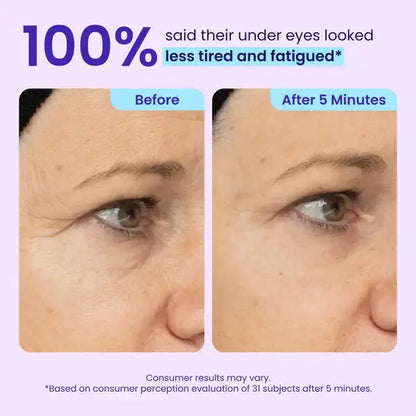 Herblow Eye Bag Instant Eraser, Tightens, Firms, & Blurs Wrinkles