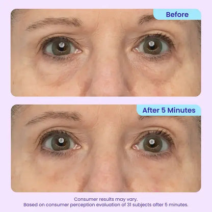 Herblow Eye Bag Instant Eraser, Tightens, Firms, & Blurs Wrinkles