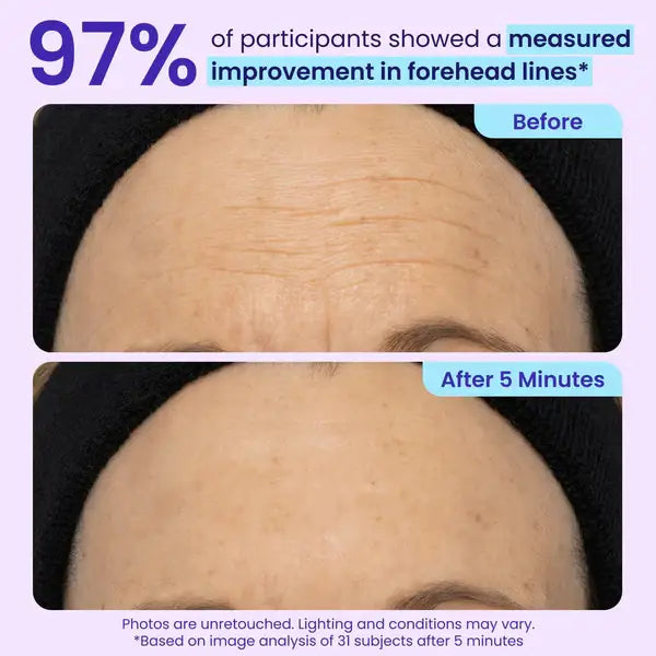Herblow Eye Bag Instant Eraser, Tightens, Firms, & Blurs Wrinkles