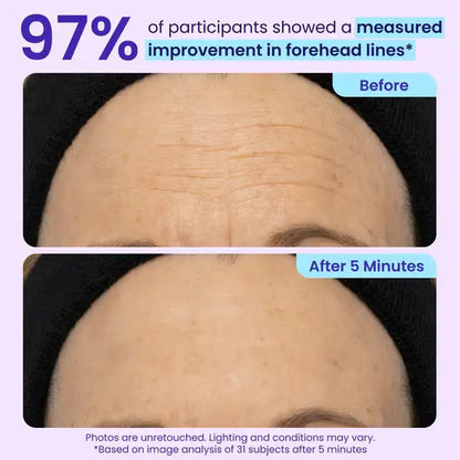 Herblow Eye Bag Instant Eraser, Tightens, Firms, & Blurs Wrinkles
