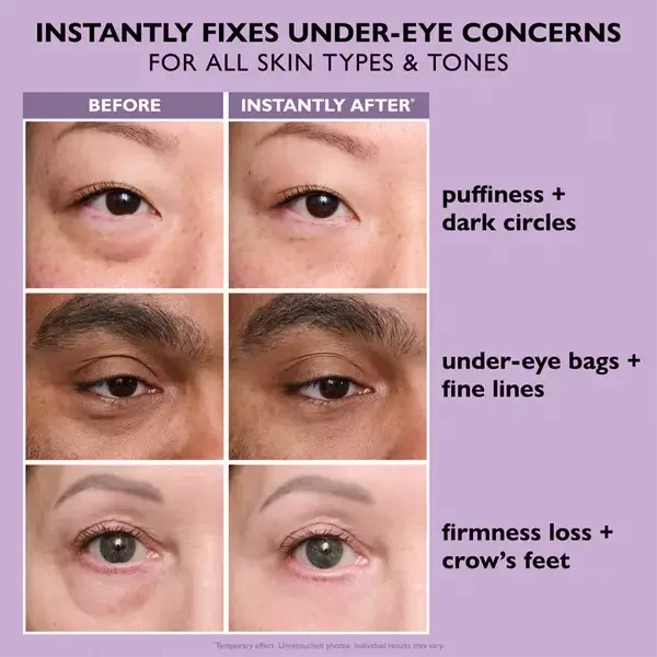 Herblow Eye Bag Instant Eraser, Tightens, Firms, & Blurs Wrinkles